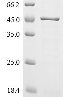 Rickettsia conorii Outer membrane protein B (ompB), partial Recombinant Protein, C-His-Avi - BioCrest Sci