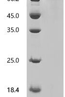 Dog Transferrin receptor protein 1 (TFRC), partial Recombinant Protein - BioCrest Sci