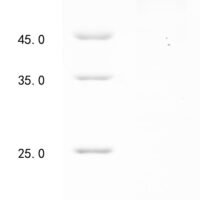 Mouse 1-phosphatidylinositol 4,5-bisphosphate phosphodiesterase delta-1 (Plcd1) Recombinant Protein, N-10His/C-Myc - BioCrest Sci