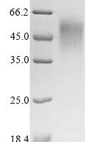 Epstein-Barr virus Epstein-Barr nuclear antigen 2 (EBNA2), partial Recombinant Protein, N-His/C-Myc - BioCrest Sci