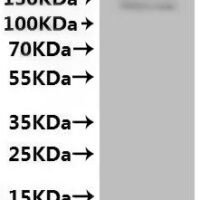 Macaca nemestrina Transient receptor potential cation channel subfamily V member 6 (TRPV6)-VLPs Recombinant Protein - BioCrest Sci