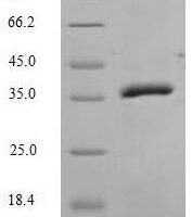 Human Caspase-14 (CASP14) Recombinant Protein - BioCrest Sci