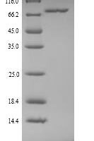 Human Clathrin interactor 1 (CLINT1) Recombinant Protein, N-His, aa 1–625, Yeast - BioCrest Sci