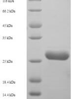 Human NADH dehydrogenase [ubiquinone] 1 beta subcomplex subunit 5, mitochondrial (NDUFB5), partial Recombinant Protein - BioCrest Sci