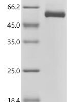 Human Netrin-4 (NTN4), partial Recombinant Protein, C-10His - BioCrest Sci