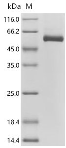 Human Netrin-4 (NTN4), partial Recombinant Protein, C-10His, Homo sapiens (Human), Mammalian cell, C-terminal 10xHis-tagged, 48.8 kDa, purity >≥ 95% as determined by SDS-PAGE.