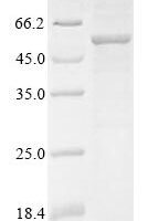 Human Lysosomal acid glucosylceramidase (GBA1) (N409S) Recombinant Protein - BioCrest Sci