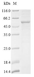 Human Lysosomal acid glucosylceramidase (GBA1) (N409S) Recombinant Protein, Homo sapiens (Human), Baculovirus, N-terminal 10xHis-tagged, 58.1 kDa, purity >≥ 85% as determined by SDS-PAGE.