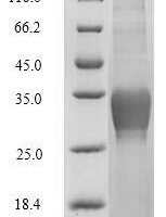 Human C-type lectin domain family 4 member C (CLEC4C), partial Recombinant Protein - BioCrest Sci