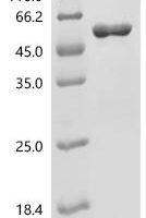 Human Filamin-B (FLNB) (T2177A,V2354A,R2374A), partial Recombinant Protein - BioCrest Sci