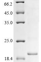 Influenza A virus Nuclear export protein (NEP) Recombinant Protein - BioCrest Sci
