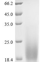 Human Mammaglobin-A (SCGB2A2) Recombinant Protein, N-His - BioCrest Sci