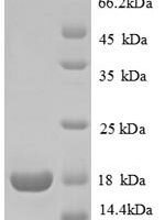 Human 60S ribosomal protein L31 (RPL31) Recombinant Protein - BioCrest Sci