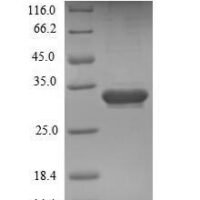 Mouse  Endothelial cell-specific molecule 1 (Esm1) Recombinant Protein - BioCrest Sci