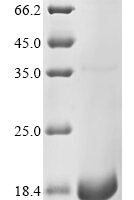 Human Excitatory amino acid transporter 1 (SLC1A3), partial Recombinant Protein, C-His - BioCrest Sci