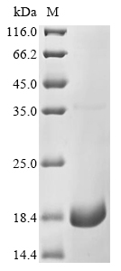 Human Excitatory amino acid transporter 1 (SLC1A3), partial Recombinant Protein, C-His, Homo sapiens (Human), Yeast, C-terminal 6xHis-tagged, 11.7 kDa, purity >≥ 90% as determined by SDS-PAGE.