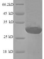 Human Endothelin-1 (EDN1), partial Recombinant Protein - BioCrest Sci