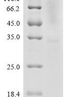 Human Delta(14)-sterol reductase LBR (LBR), partial Recombinant Protein, N-His-SUMOstar - BioCrest Sci