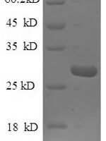 Human Mannose-binding protein C (MBL2) Recombinant Protein, N-His - BioCrest Sci
