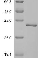 Human Oxaloacetate tautomerase FAHD1, mitochondrial (FAHD1) Recombinant Protein, C-His - BioCrest Sci