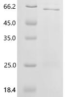 Human Roundabout homolog 3 (ROBO3), partial Recombinant Protein, C-His, aa 913–1386 - BioCrest Sci