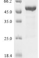 Human Meiotic recombination protein SPO11 (SPO11) Recombinant Protein, C-His, aa 1–396, E.coli - BioCrest Sci