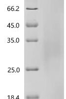 Human Collagen alpha-1 (XVIII) chain (COL18A1), partial Recombinant Protein, C-His - BioCrest Sci