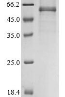 Avian infectious bronchitis virus Nucleoprotein (N) Recombinant Protein, C-His, aa 1–409, strain SAIB20, Mammalian cell - BioCrest Sci