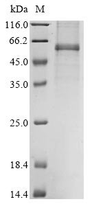 Avian infectious bronchitis virus Nucleoprotein (N) Recombinant Protein, C-His, aa 1–409, strain SAIB20, Mammalian cell, Avian infectious bronchitis virus (strain SAIB20) (IBV), Mammalian cell, C-terminal 6xHis-tagged, 47.3 kDa, purity >≥ 85% as determined by SDS-PAGE.