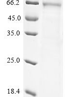 Mouse Desmoglein-3 (Dsg3), partial Recombinant Protein, C-His, aa 50–617, Purity ≥85% - BioCrest Sci