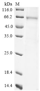 Mouse Desmoglein-3 (Dsg3), partial Recombinant Protein, C-His, aa 50–617, Purity ≥85%, Mus musculus (Mouse), Baculovirus, C-terminal 6xHis-tagged, 66.5 kDa, purity >≥ 85% as determined by SDS-PAGE.