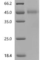 Human Galectin-9 (LGALS9), partial Recombinant Protein, N-10His - BioCrest Sci