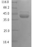 Human Plasma kallikrein (KLKB1), partial Recombinant Protein - BioCrest Sci
