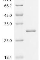 Staphylococcus aureus Bifunctional protein pyrR (pyrR) Recombinant Protein - BioCrest Sci