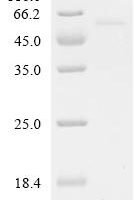 Human Hyaluronidase PH-20 (SPAM1) Recombinant Protein, C-His, aa 36–490, Yeast - BioCrest Sci