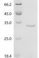 Mouse Apoptosis-associated speck-like protein containing a CARD (Pycard) Recombinant Protein, C-10His - BioCrest Sci