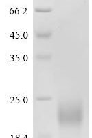 Porcine reproductive and respiratory syndrome virus Nucleoprotein (N) Recombinant Protein, C-10His - BioCrest Sci