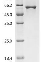 Human E3 ubiquitin-protein ligase TRIM15 (TRIM15) Recombinant Protein - BioCrest Sci