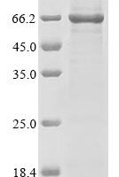 Lassa virus Nucleoprotein (N) Recombinant Protein, N-10His/C-Myc - BioCrest Sci
