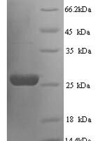 Rat Suppressor of cytokine signaling 3 (Socs3) Recombinant Protein, N-His - BioCrest Sci