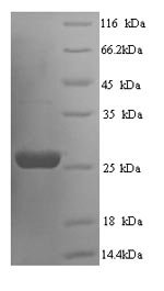 Rat Suppressor of cytokine signaling 3 (Socs3) Recombinant Protein, N-His, Rattus norvegicus (Rat), Yeast, N-terminal 6xHis-tagged, 26.8 kDa, purity >≥ 90% as determined by SDS-PAGE.