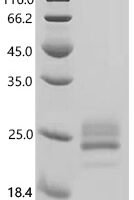 Mouse Interleukin-6 (Il6) Recombinant Protein, C-10His - BioCrest Sci
