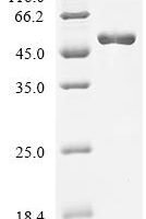 Escherichia coli Elongation factor Tu 2 (tufB) Recombinant Protein - BioCrest Sci