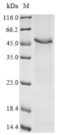 Human Ribonuclease inhibitor (RNH1) Recombinant Protein, N-His, Homo sapiens (Human), E.coli, N-terminal 6xHis-tagged, 53.9 kDa, purity >≥ 85% as determined by SDS-PAGE.