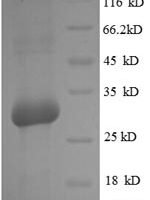 Rat Osteocalcin (Bglap) Recombinant Protein - BioCrest Sci