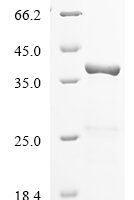 Human U1 small nuclear ribonucleoprotein A (SNRPA) Recombinant Protein, N-10His/C-Myc - BioCrest Sci