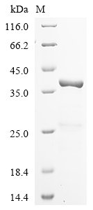Human U1 small nuclear ribonucleoprotein A (SNRPA) Recombinant Protein, N-10His/C-Myc, Homo sapiens (Human), E.coli, N-terminal 10xHis-tagged and C-terminal Myc-tagged, 38.6 kDa, purity >≥ 85% as determined by SDS-PAGE.
