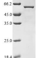 Thermus aquaticus DNA polymerase I, thermostable (polA) (M747K), partial Recombinant Protein - BioCrest Sci