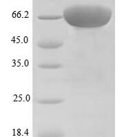 Human Desmoglein-3 (DSG3), partial Recombinant Protein, N-His - BioCrest Sci