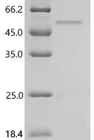 Human Homeobox protein Nkx-2.1 (NKX2-1) Recombinant Protein - BioCrest Sci